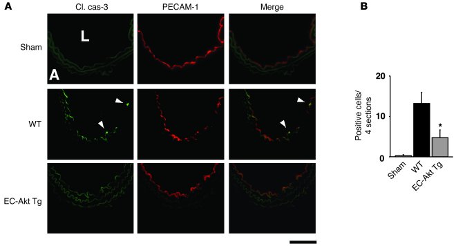 Immunostaining for cleaved (activated) caspase-3 in ligated carotid arte...