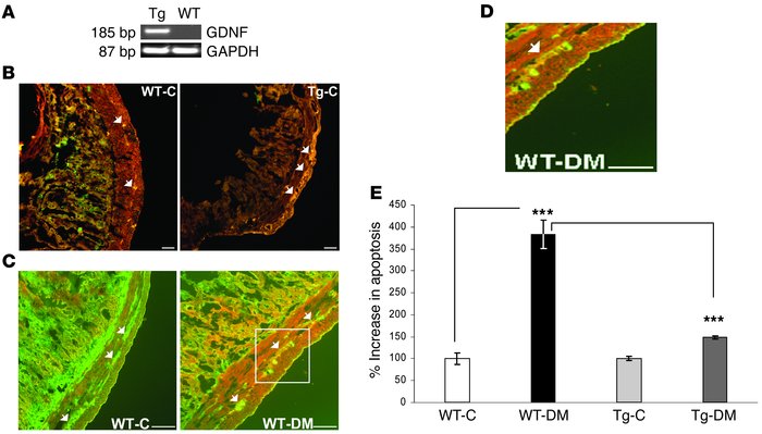 Diabetes is associated with increased cleaved caspase-3 staining in myen...