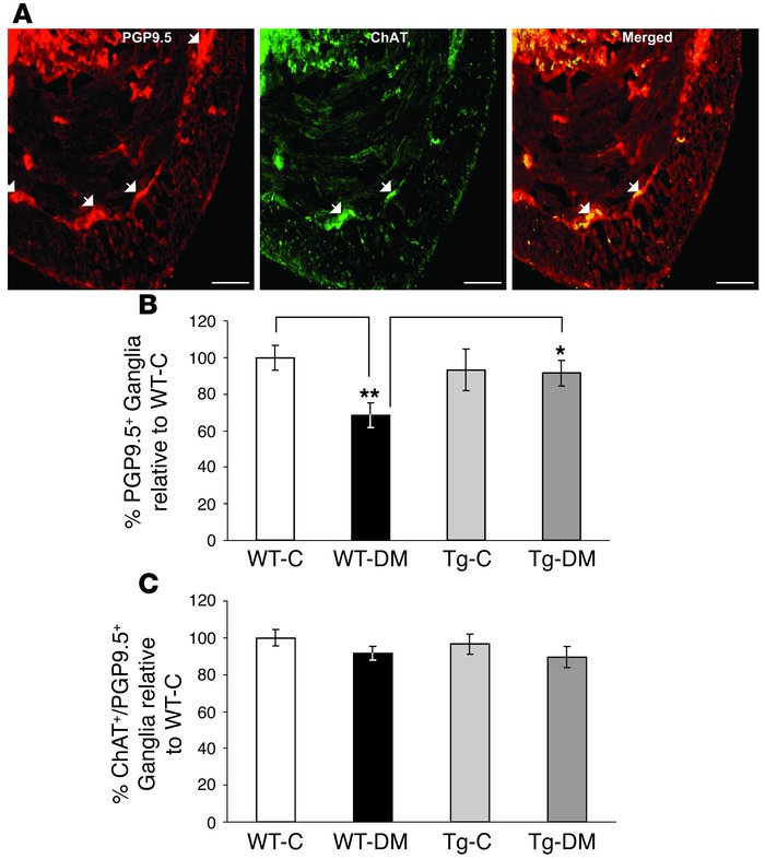 Assessment of PGP9.5 and ChAT-stained neurons in WT and Tg mice. (A) Rep...