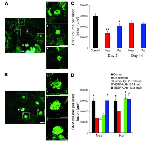 Preexisting CNV inhibited subsequent CNV via VEGF-A. (A and B) Represent...