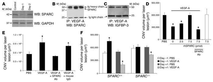 SPARC regulated VEGF-A effects on CNV. (A) Constitutive (control) RPE/ch...