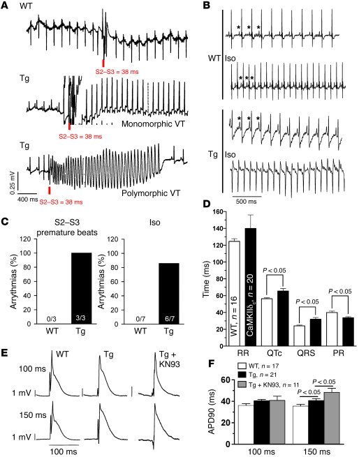 Arrhythmias in CaMKIIδC-Tg mice.
               
(A) Original ECG traces...