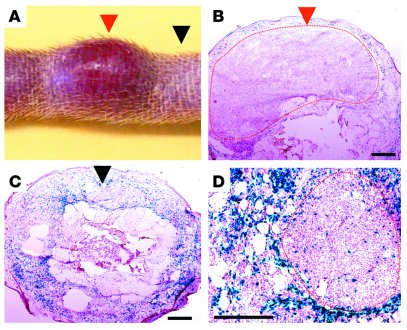 
Tumors from DOX-treated iOFR74/LacZ mice contain few LacZ+
cells.
(A) R...