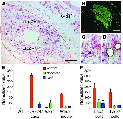 
                  LacZ–
                  cells in tumors of transplant...