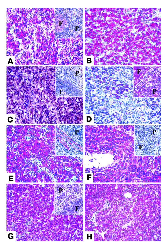 Immunohistochemical validation of gene expression results on TMAs.
Examp...