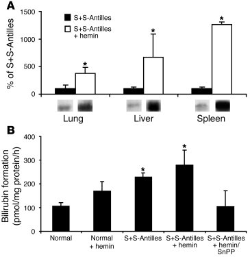 Hemin increases HO-1 expression.
(A) HO-1 expression can be further upre...