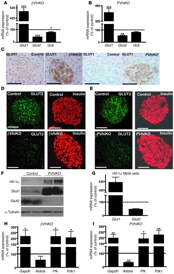 Abnormal expression of glucose-sensing apparatus and glycolytic genes in...