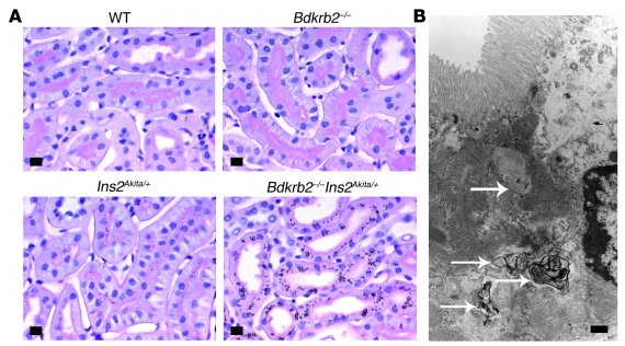 Kidneys of 12-month-old mice of the 4 genotypes.
(A) PAS-stained kidneys...