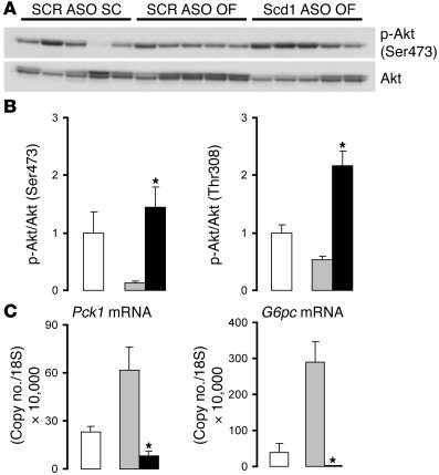 Scd1 deficiency enhances hepatic insulin action in OF rats.
(A) Western ...