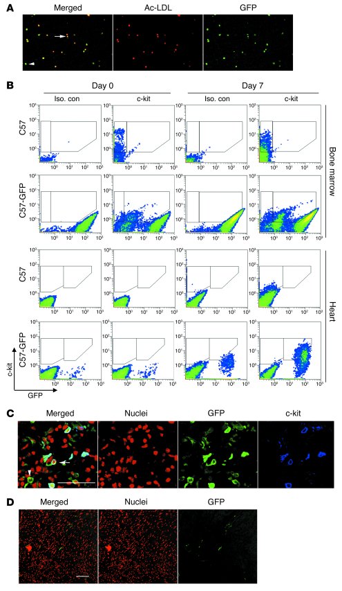 
                  c-kit+
                  cells in infarcted myocardiu...