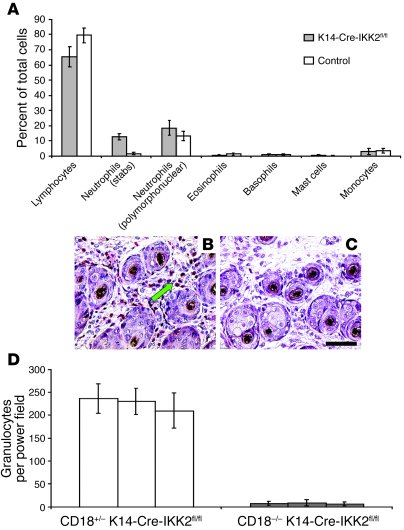 
                  Targeted deletion of CD18 prevents granulocyte migrat...