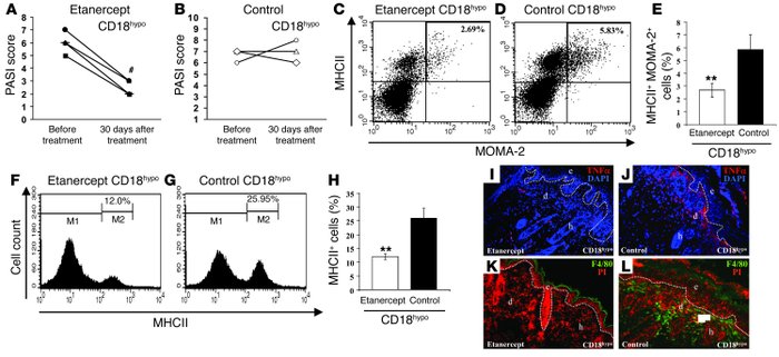 
                  Reduction of the psoriasiform phenotype of affectedCD...