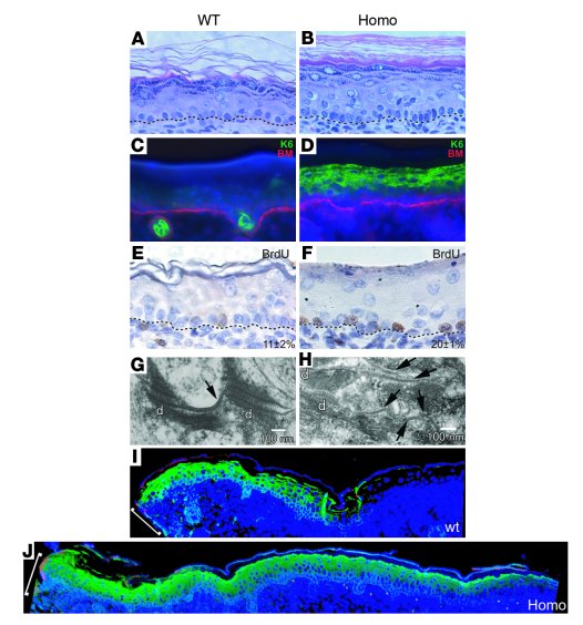 Histology of homozygous Inv-Cx26 mice with hyperkeratosis, hyperprolifer...