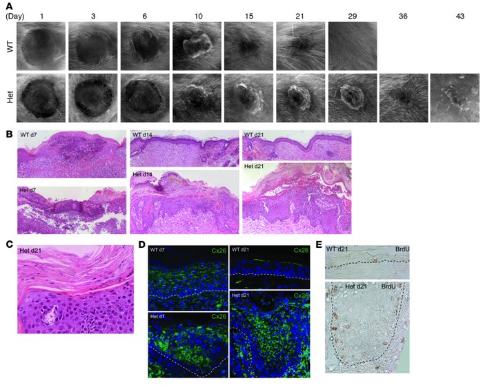 Heterozygous Inv-Cx26 mice reepithelialize wounds but fail to remodel an...