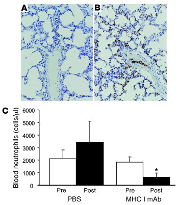 MHC I mAb–treated mice develop lung neutrophil sequestration and neutrop...