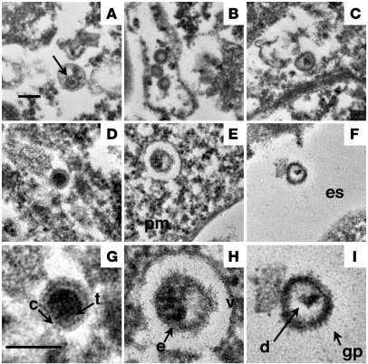 Thin section EM of NOD/SCID-hu spleens demonstrated virion production 3 ...