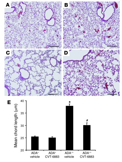 
                  CVT-6883 treatment inhibits alveolar airway enlargeme...