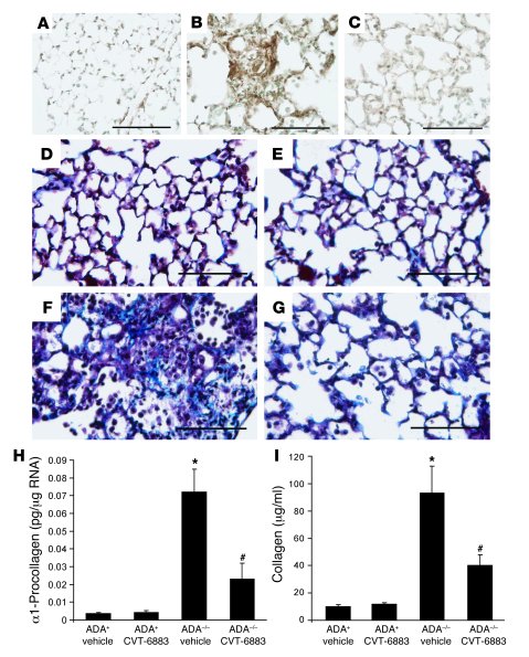 
                  Pulmonary fibrosis inADA–/–
                  mice tr...