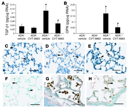 
                  CVT-6883–treatedADA–/–
                  mice had dec...