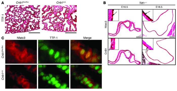 Role of TTF-1 in the regulation of CnB1 and Nfatc3 activity.
(A) Neither...