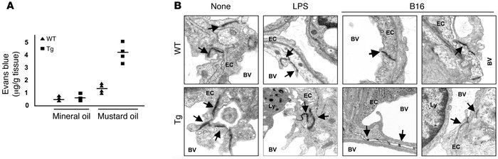 Enhanced EC leakiness in the transgenic mice.
(A) Vascular permeability ...