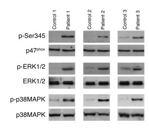 
                  Phosphorylation of p47phox
                  on Ser34...