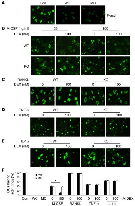 DEX inhibits M-CSF–induced actin ring formation.
WT and GRoc–/– BMMs wer...