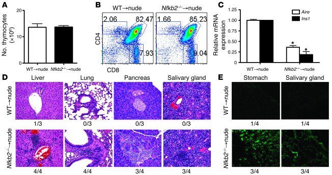 
Nfkb2–/– thymic stroma are sufficient to induce autoimmunity in thymi-g...