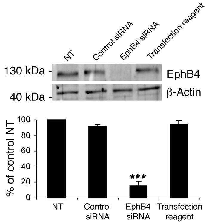 EphB4 knockdown in EPCs.
Western blot quantification of EphB4 protein de...