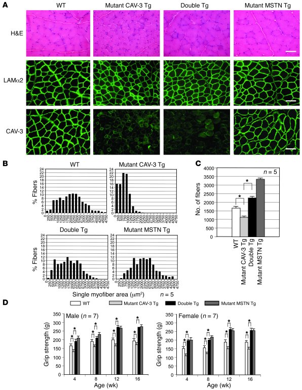 Myostatin inhibition reverses hypoplasia and hypotrophy and enhances mus...