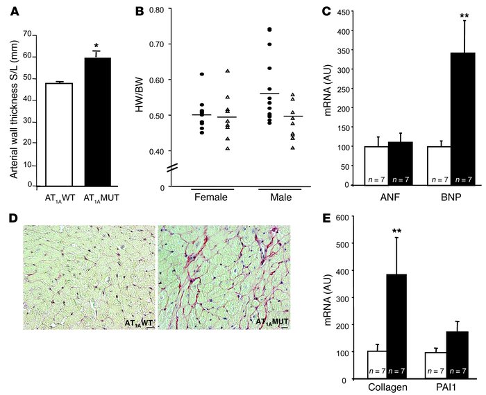 Cardiovascular characterization of AT1AMUT and AT1AWT mice.
            ...