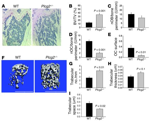 Osteopetrosis in mice lacking PLCγ2.
(A) TRAP staining of decalcified hi...