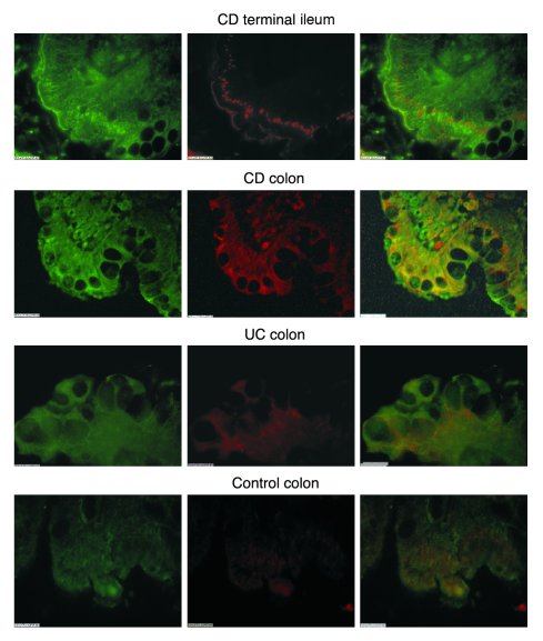 Double immunofluorescence of proteasomal immunosubunit β2i and NF-κB sub...