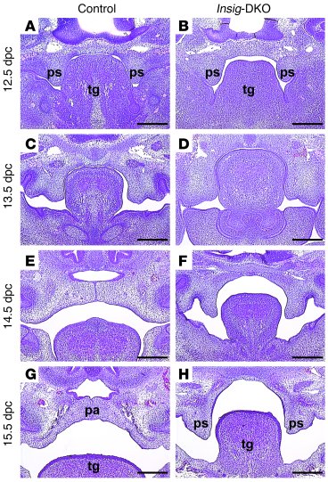 
                  Developmental study of palate formation in control an...