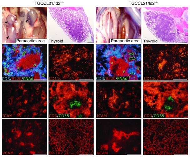 CCL21-induced formation of lymphoid structures in the thyroid does not d...