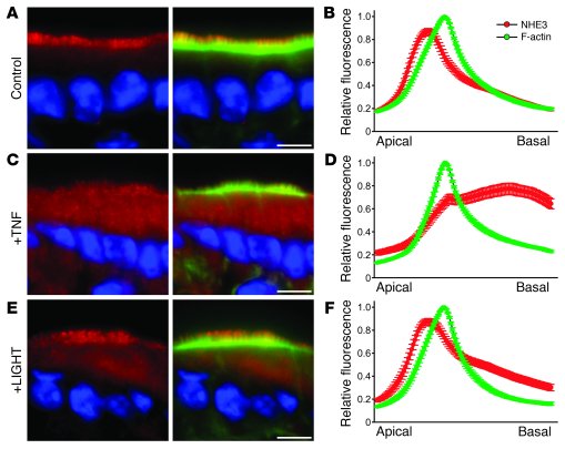 NHE3 is internalized after TNF treatment.
Immunofluorescent detection of...