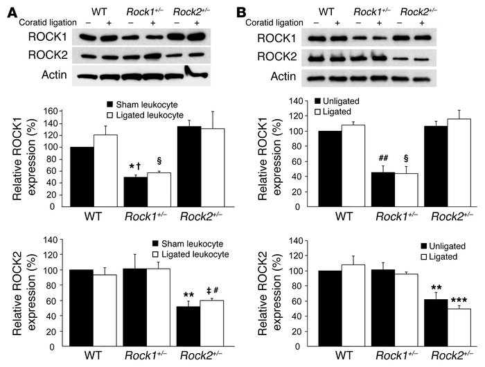 ROCK expression in leukocytes and carotids of Rock1+/– and Rock2+/– mice...