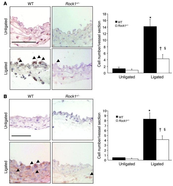 Decreased leukocyte recruitment to ligated vessels of Rock1+/– mice.
   ...