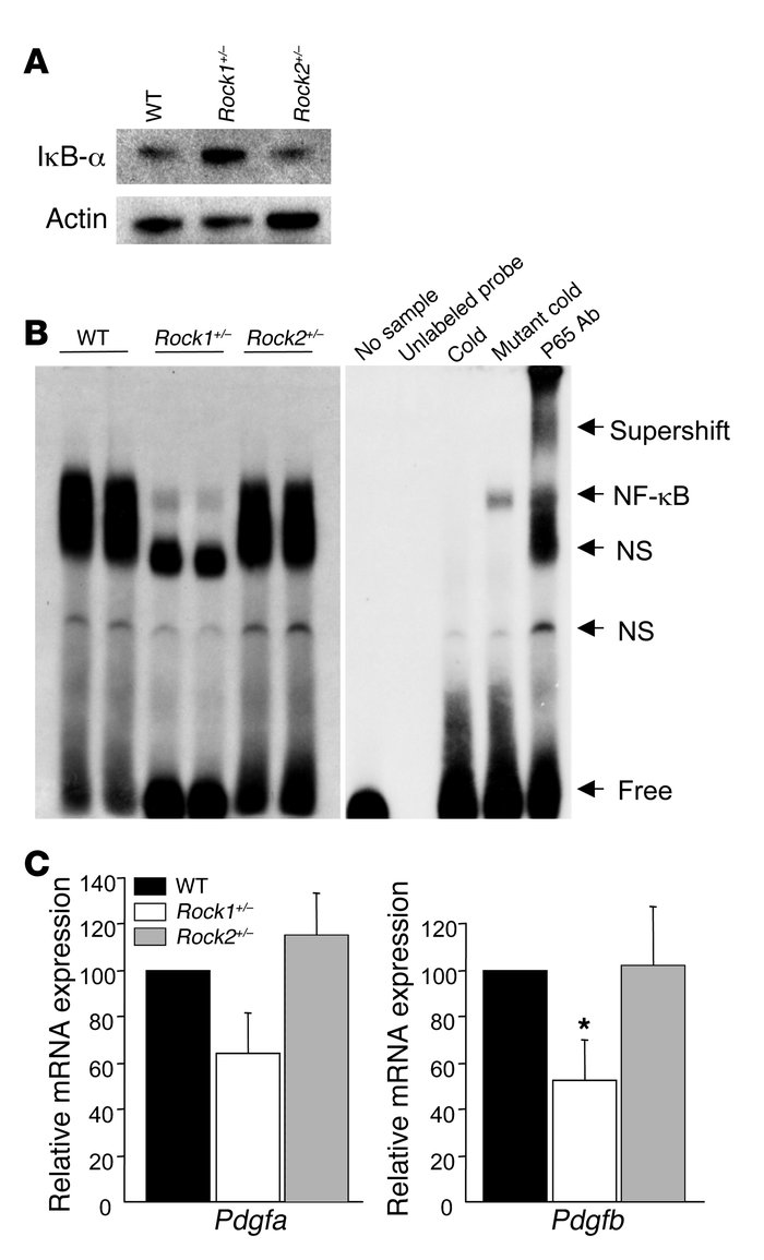 Decreased expression of PDGF-B, degradation of IκB-α, and activation of ...