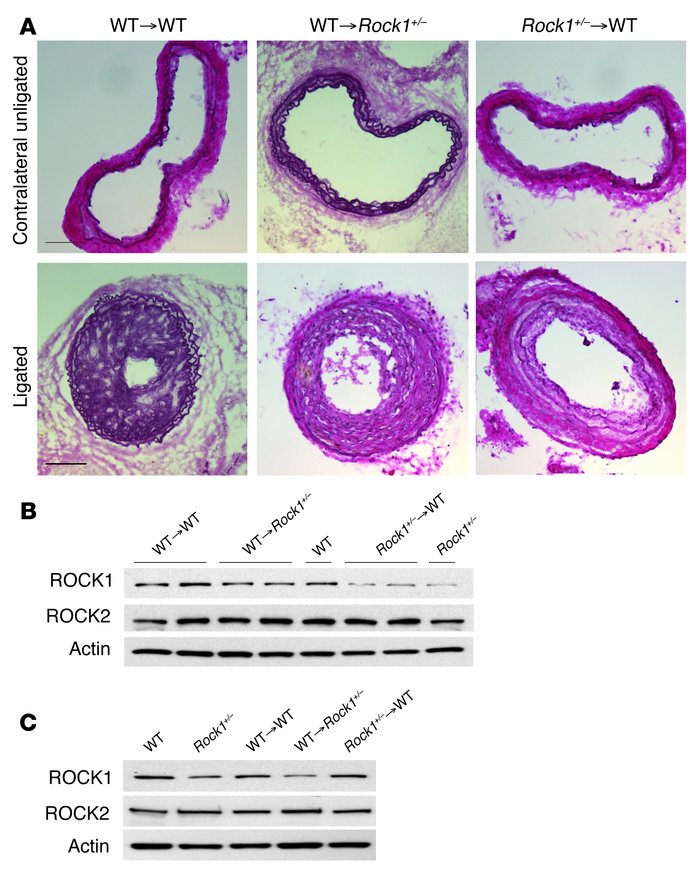 ROCK1 in BM-derived cells mediates to neointima formation.
(A) Represent...