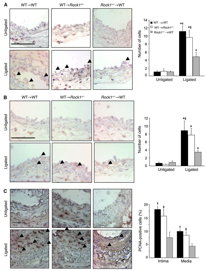 BM-derived cells contribute to leukocyte recruitment and cell proliferat...