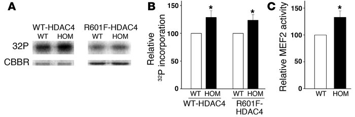 Activities of HDAC kinase and MEF2 in WT and homozygous hearts.
(A and B...