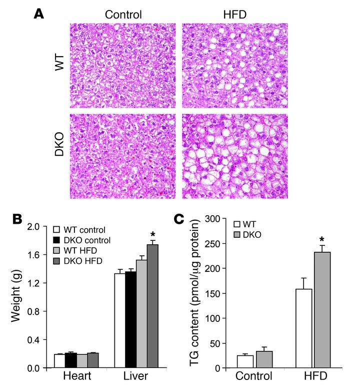 Liver histology in WT and DKO mice.
(A) Histological analysis of WT and ...