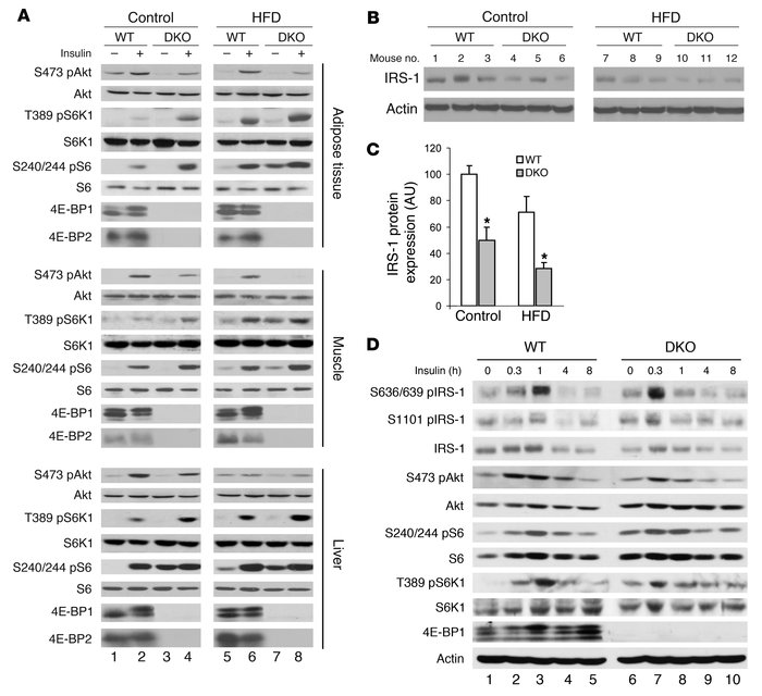 Deletion of 4E-BP1 and 4E-BP2 led to impairment of insulin signaling.
(A...