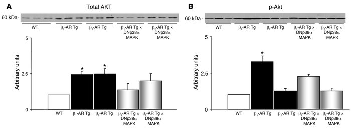 Akt.
(A) Total Akt levels were elevated significantly in β1-AR and β2-AR...