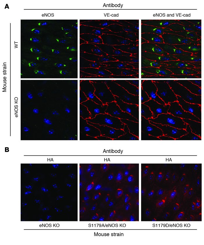 Subcellular localization of WT and transgenic eNOS.
(A) En face immunost...