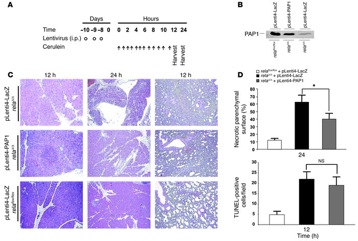 Protective effect of PAP1 on cerulein-induced pancreatitis in relaΔ/Δ mi...