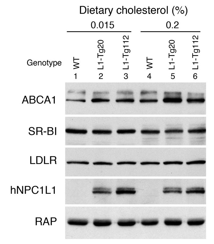 Hepatic ABCA1 protein is increased in L1-Tg mice.
The immunoblotting fil...