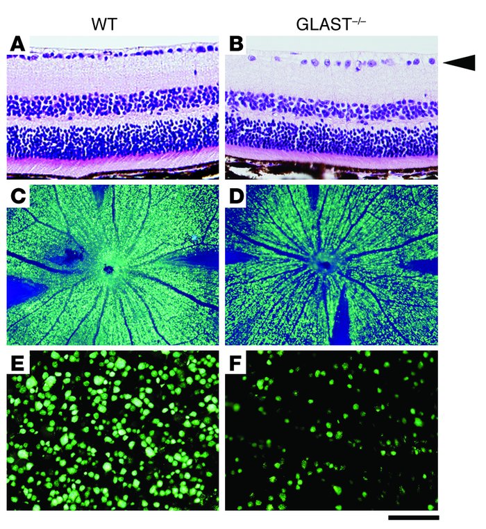 RGC degeneration in GLAST–/– mice.
               
H&amp;E-stained secti...