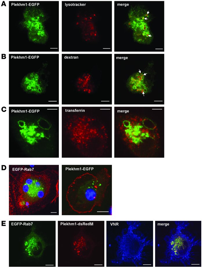 Plekhm1 colocalizes to late endosomes/lysosomes with Rab7 in prefusion o...